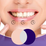 Избелващ серум за зъби GingiWhite-v34 - Image 4